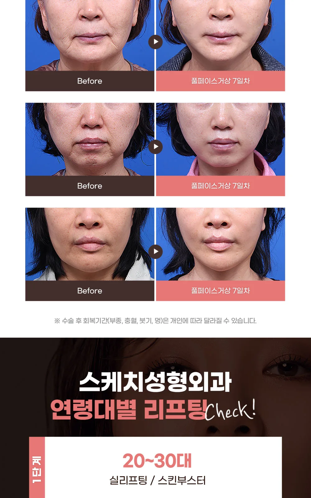 시술 상세 5