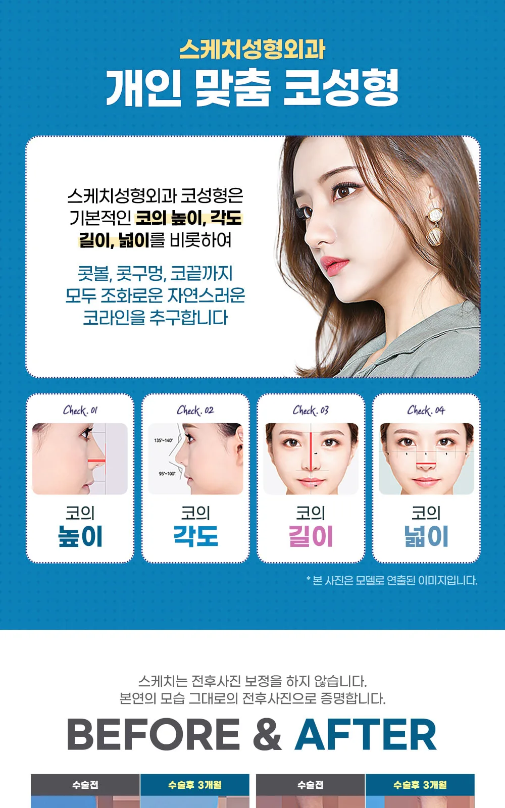 시술 상세 2