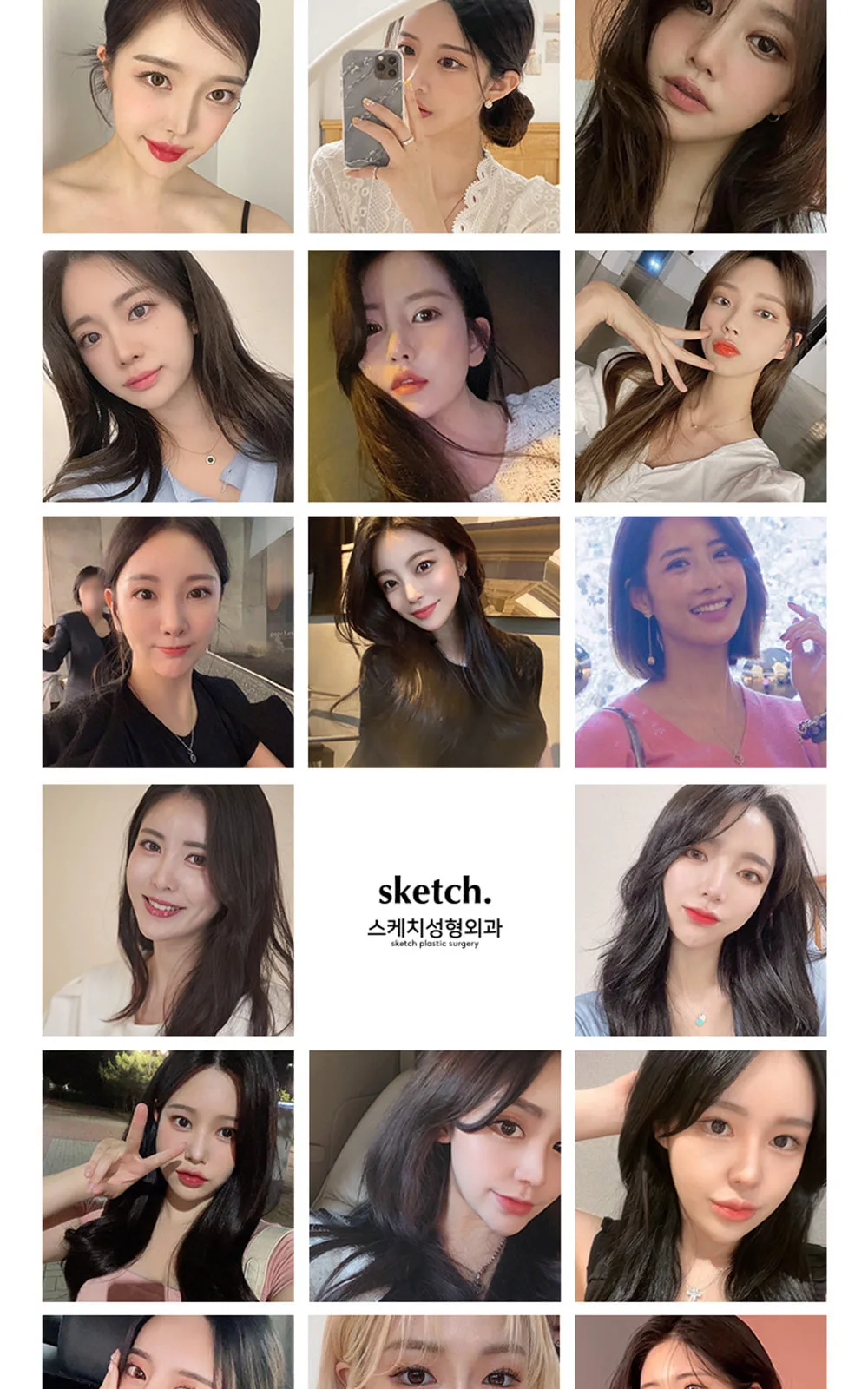 시술 상세 5