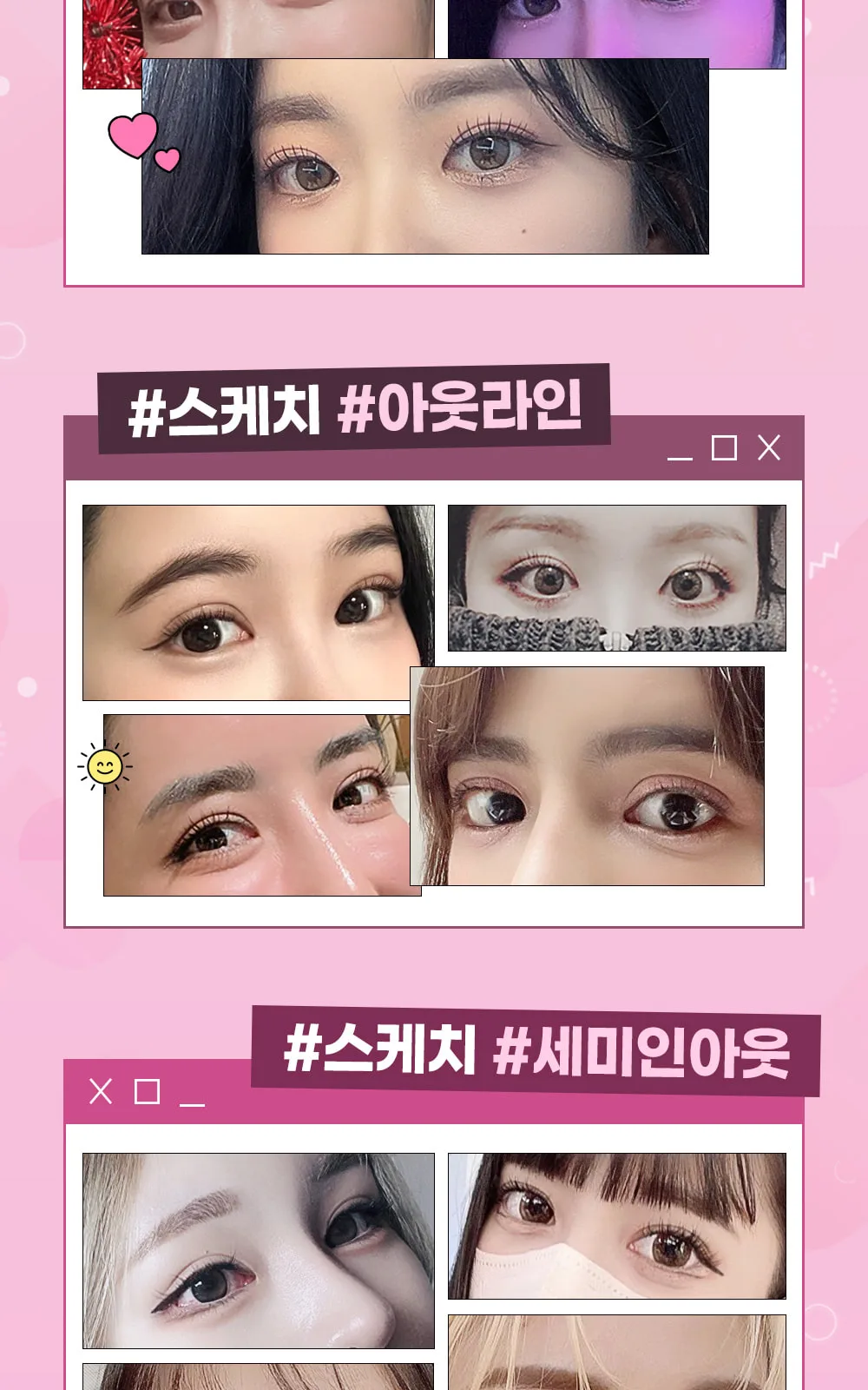 시술 상세 3