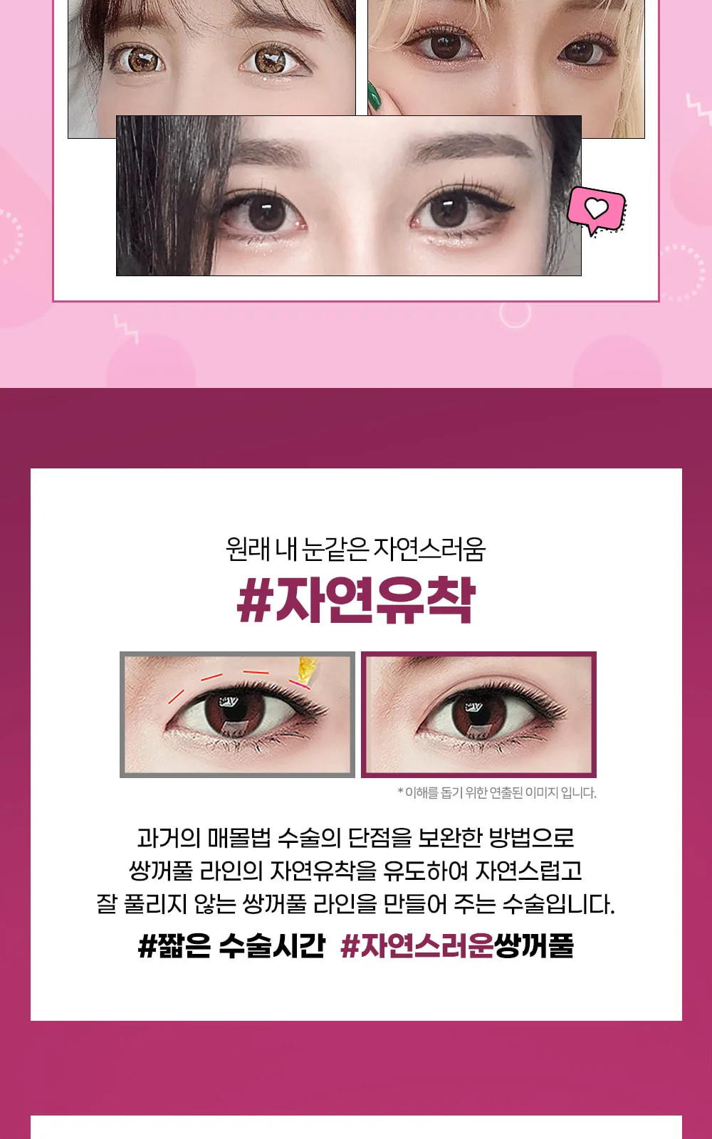 시술 상세 4