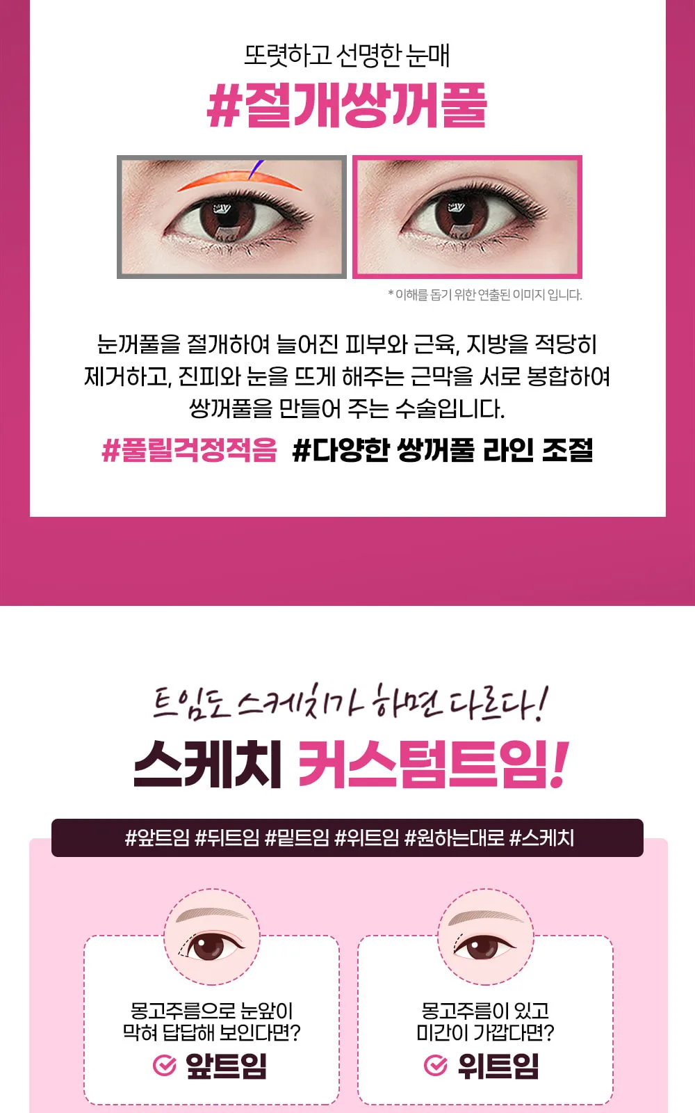 시술 상세 5