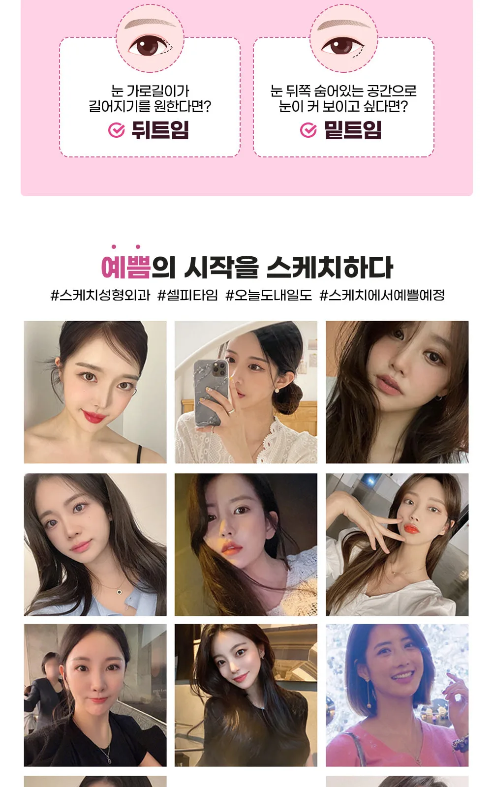 시술 상세 6