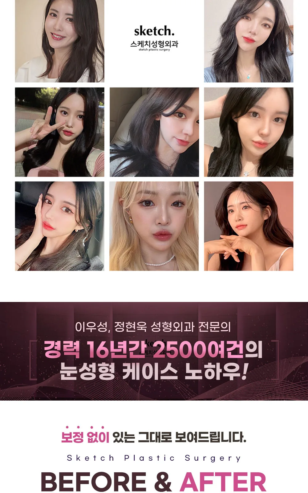 시술 상세 7