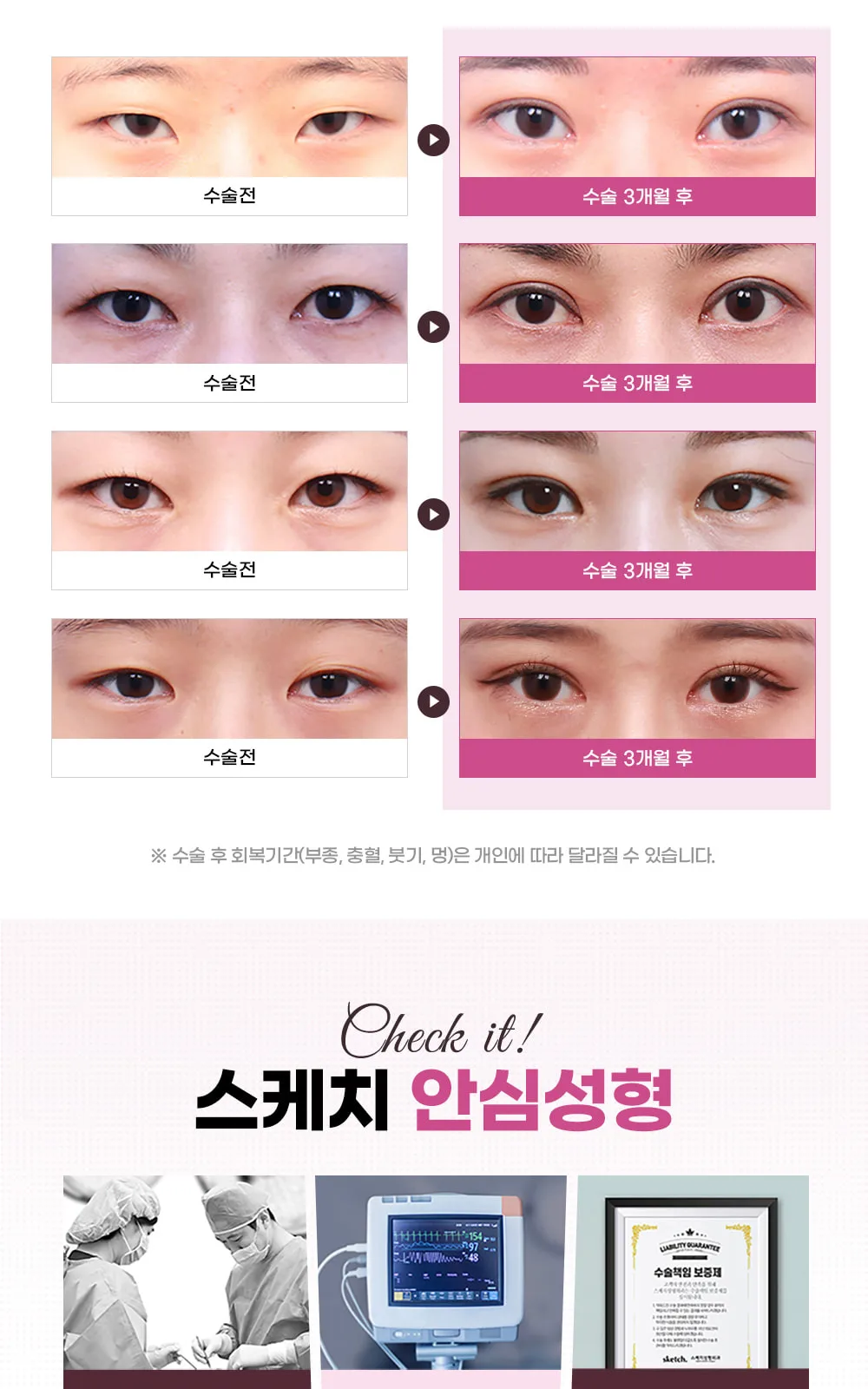 시술 상세 8
