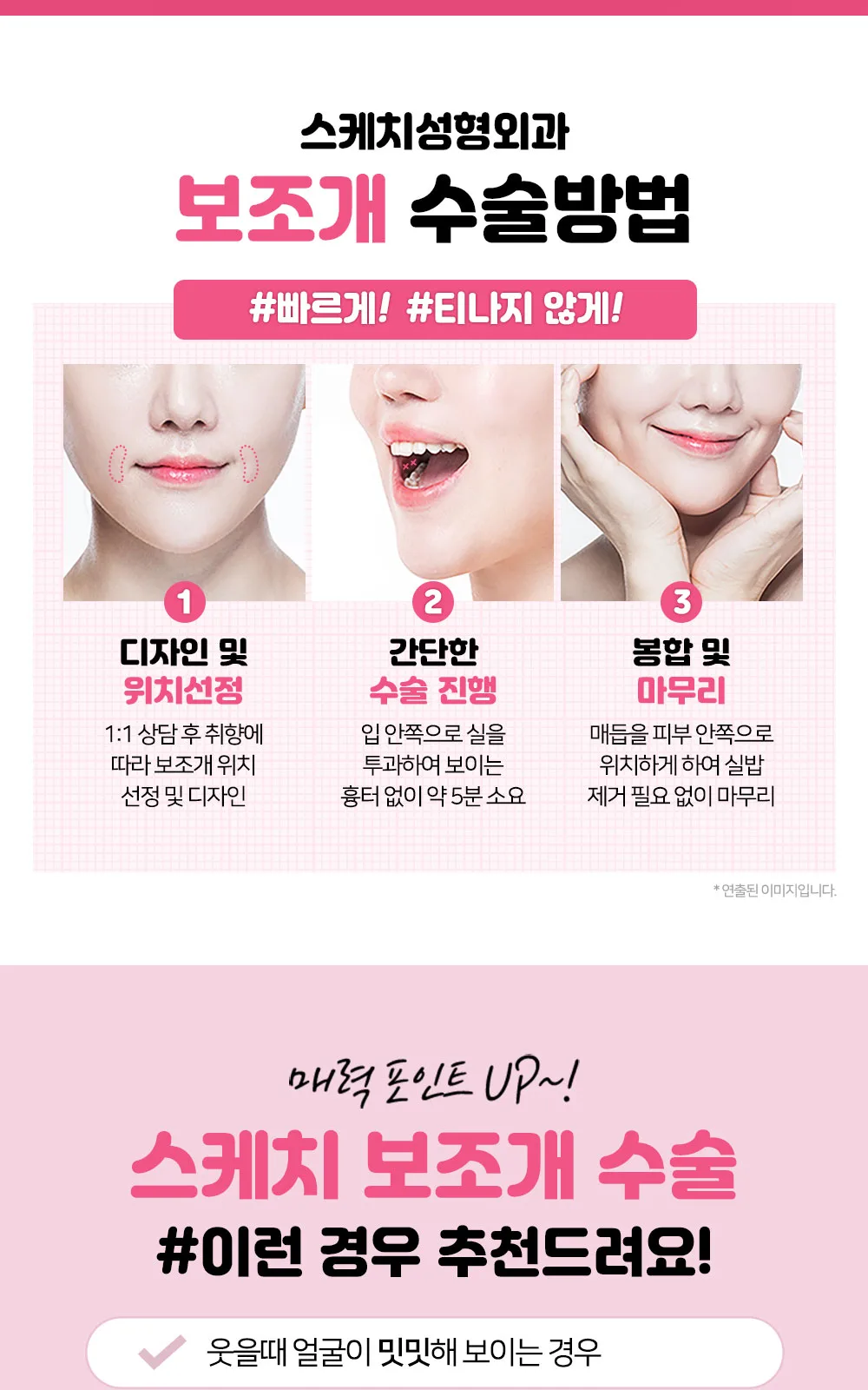 시술 상세 3