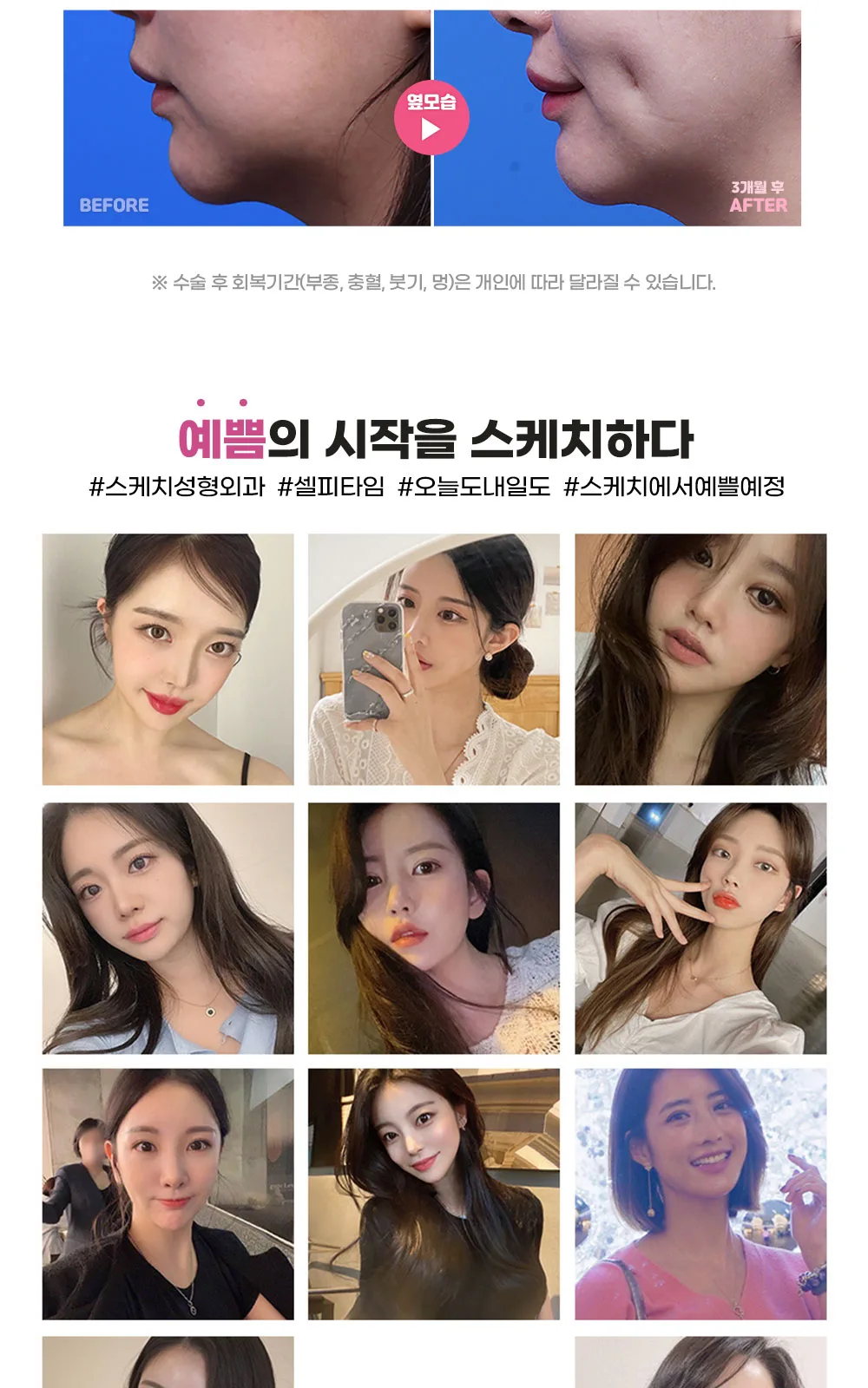 시술 상세 6