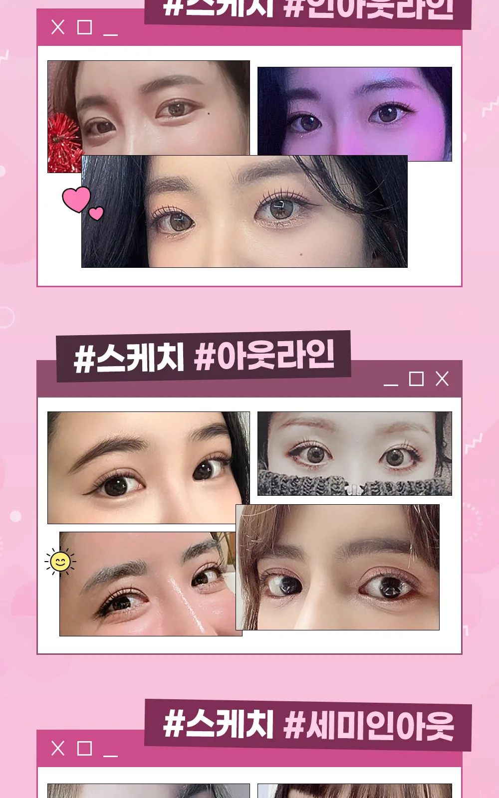 시술 상세 3