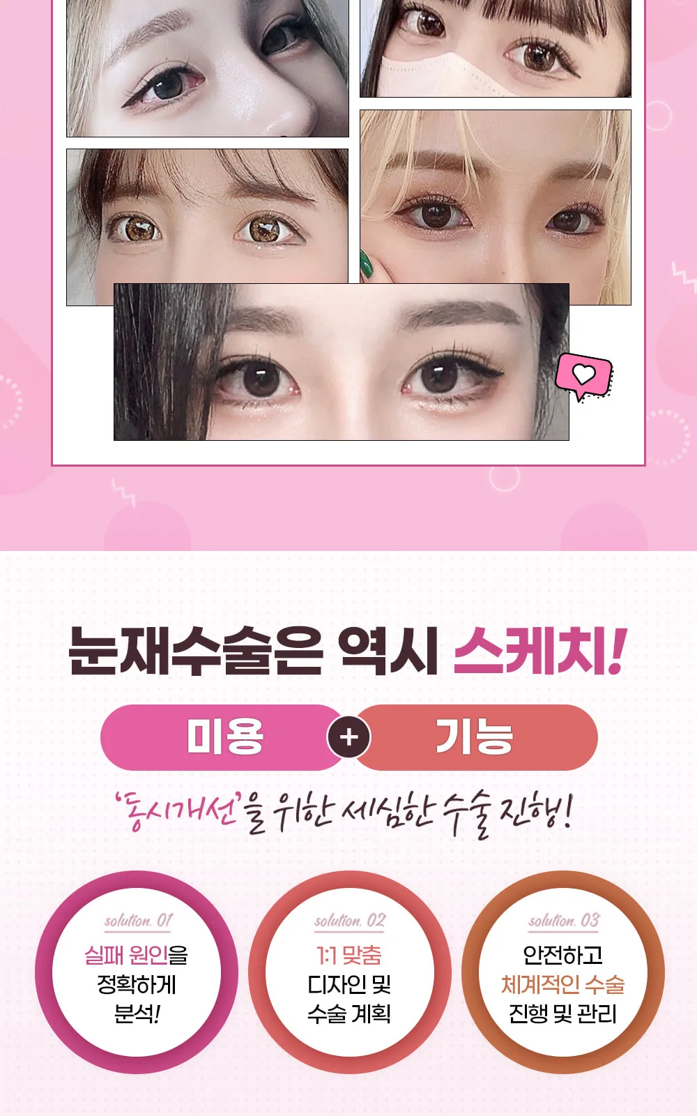 시술 상세 4