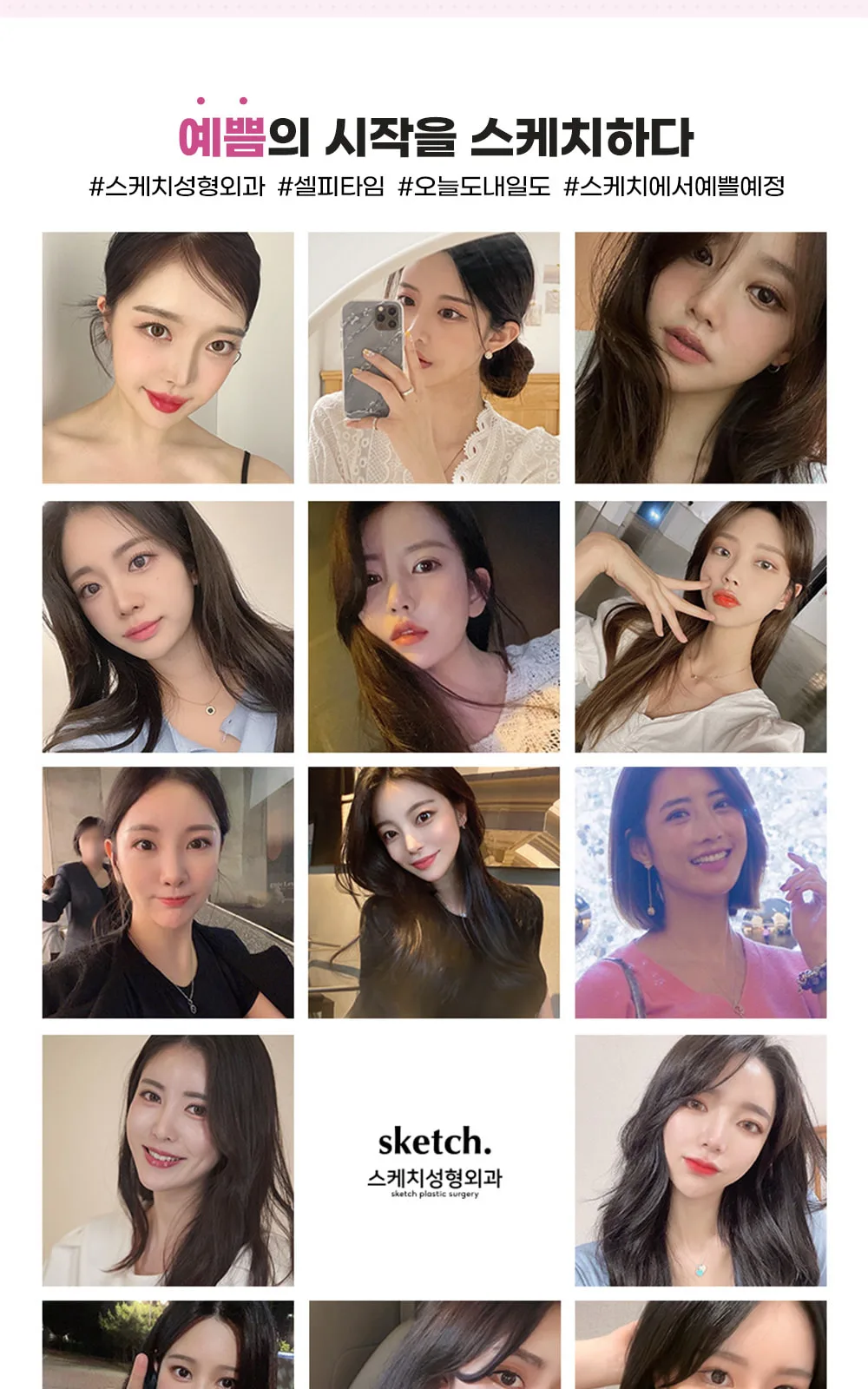 시술 상세 5