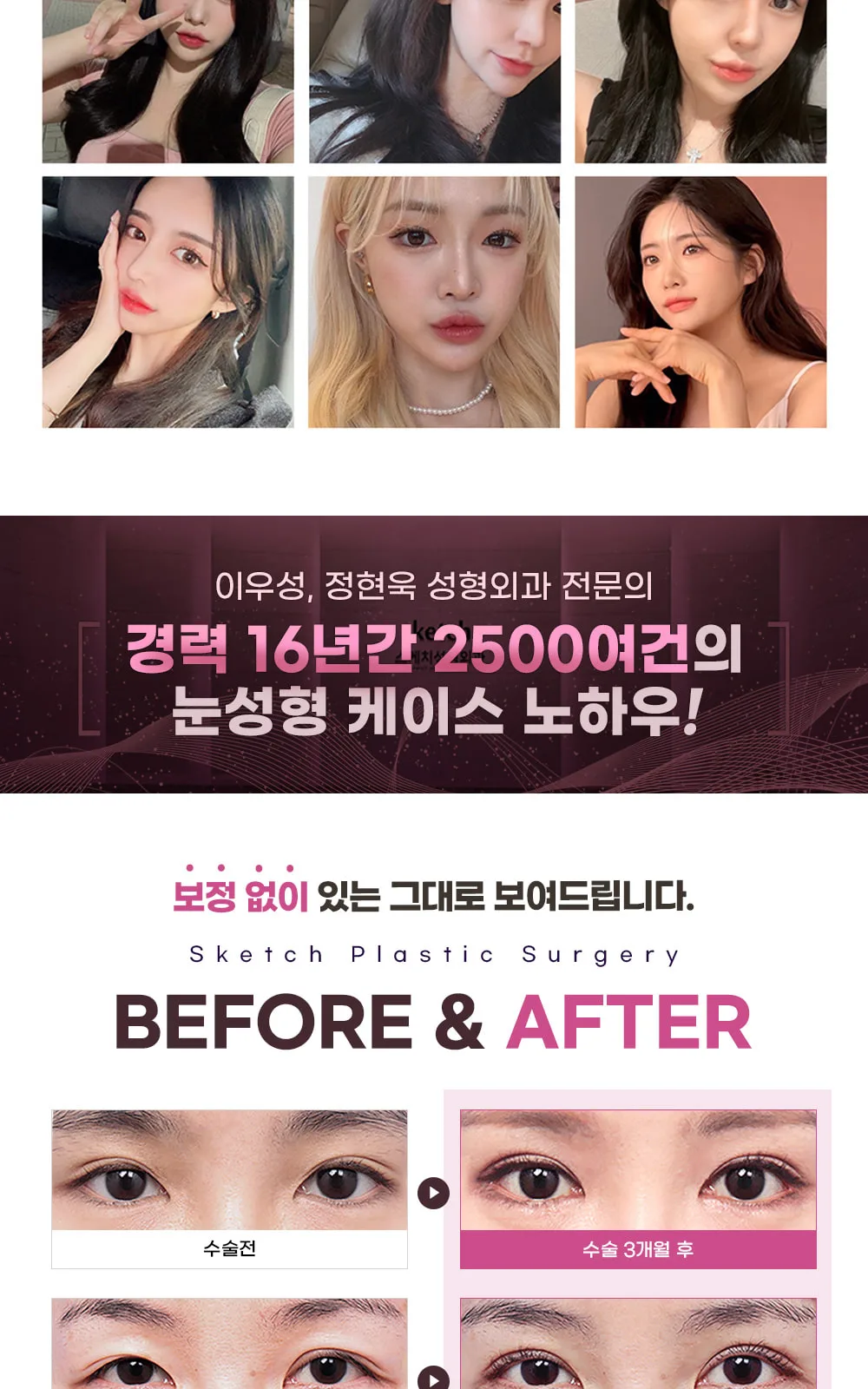 시술 상세 6