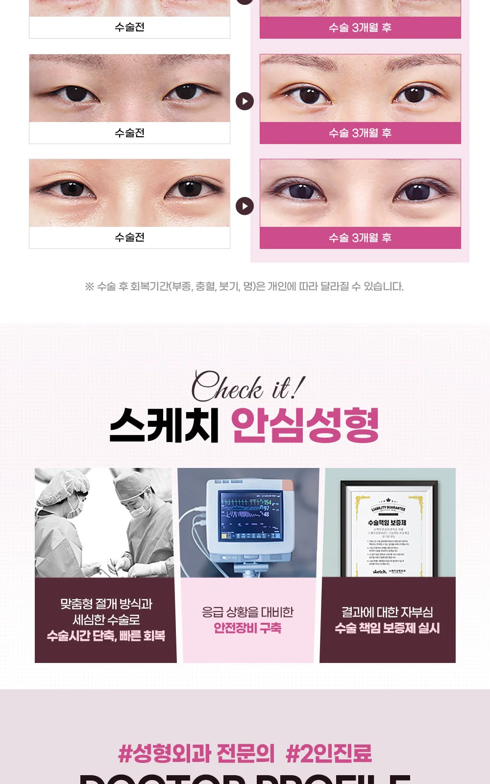 시술 상세 7