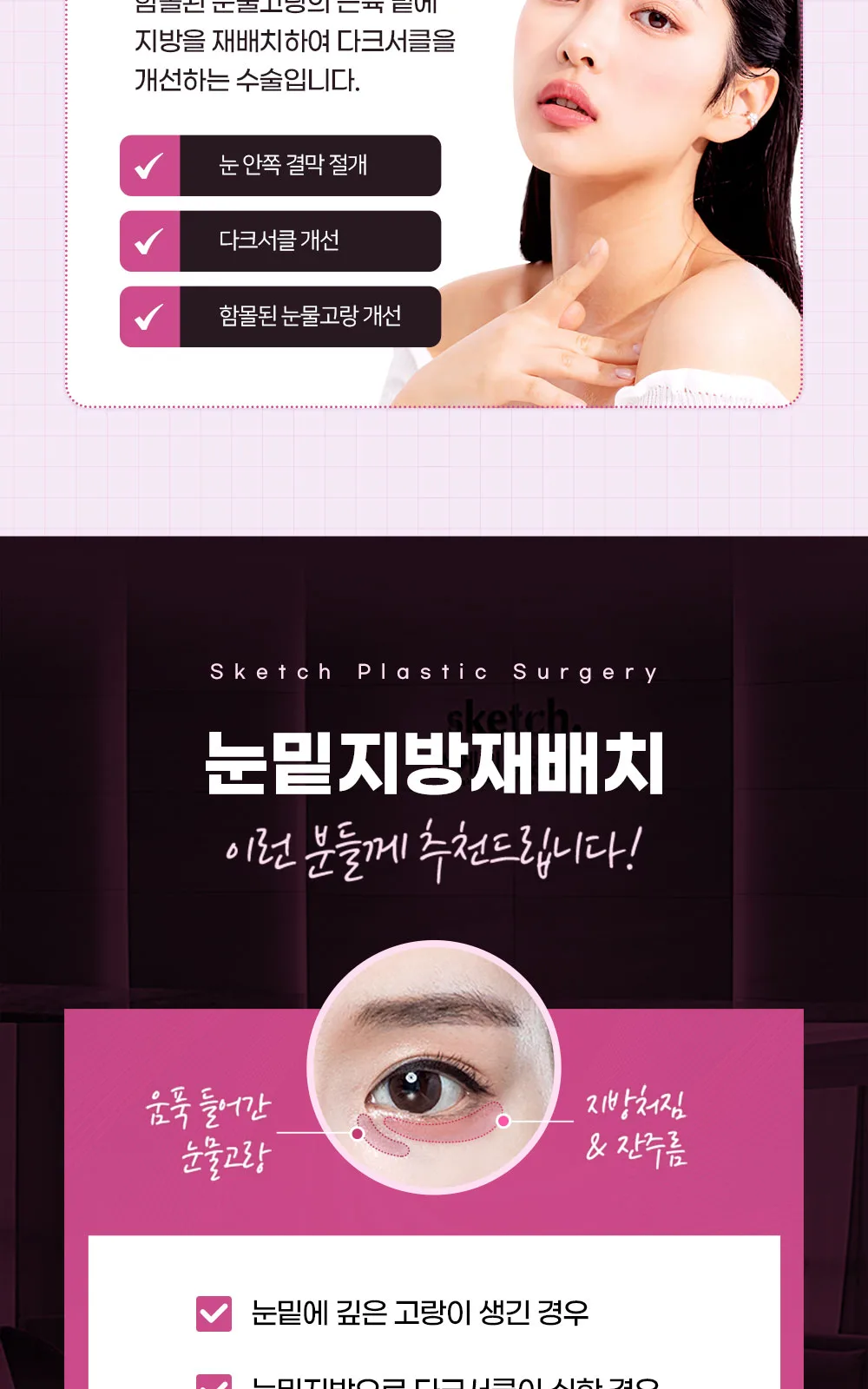 시술 상세 2