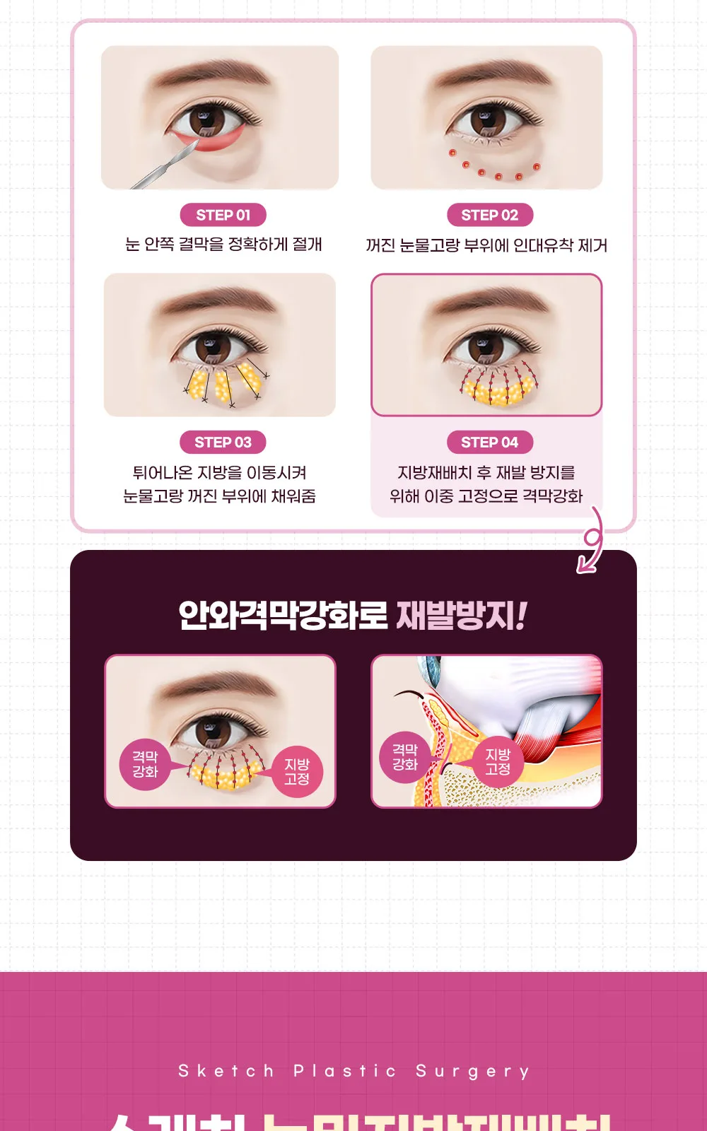 시술 상세 4