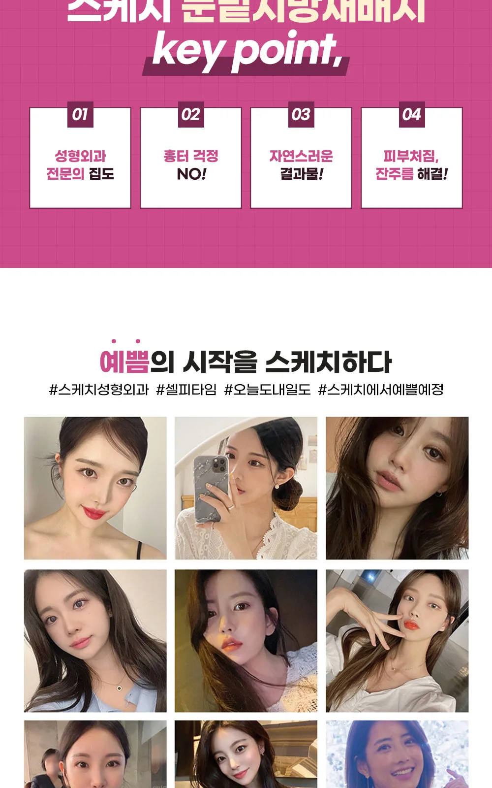 시술 상세 5