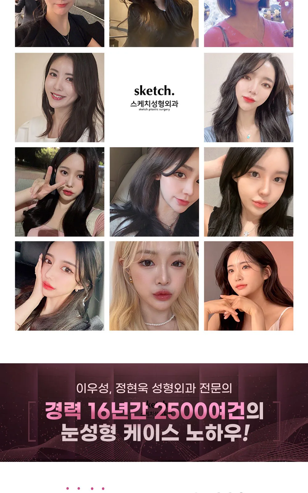 시술 상세 6