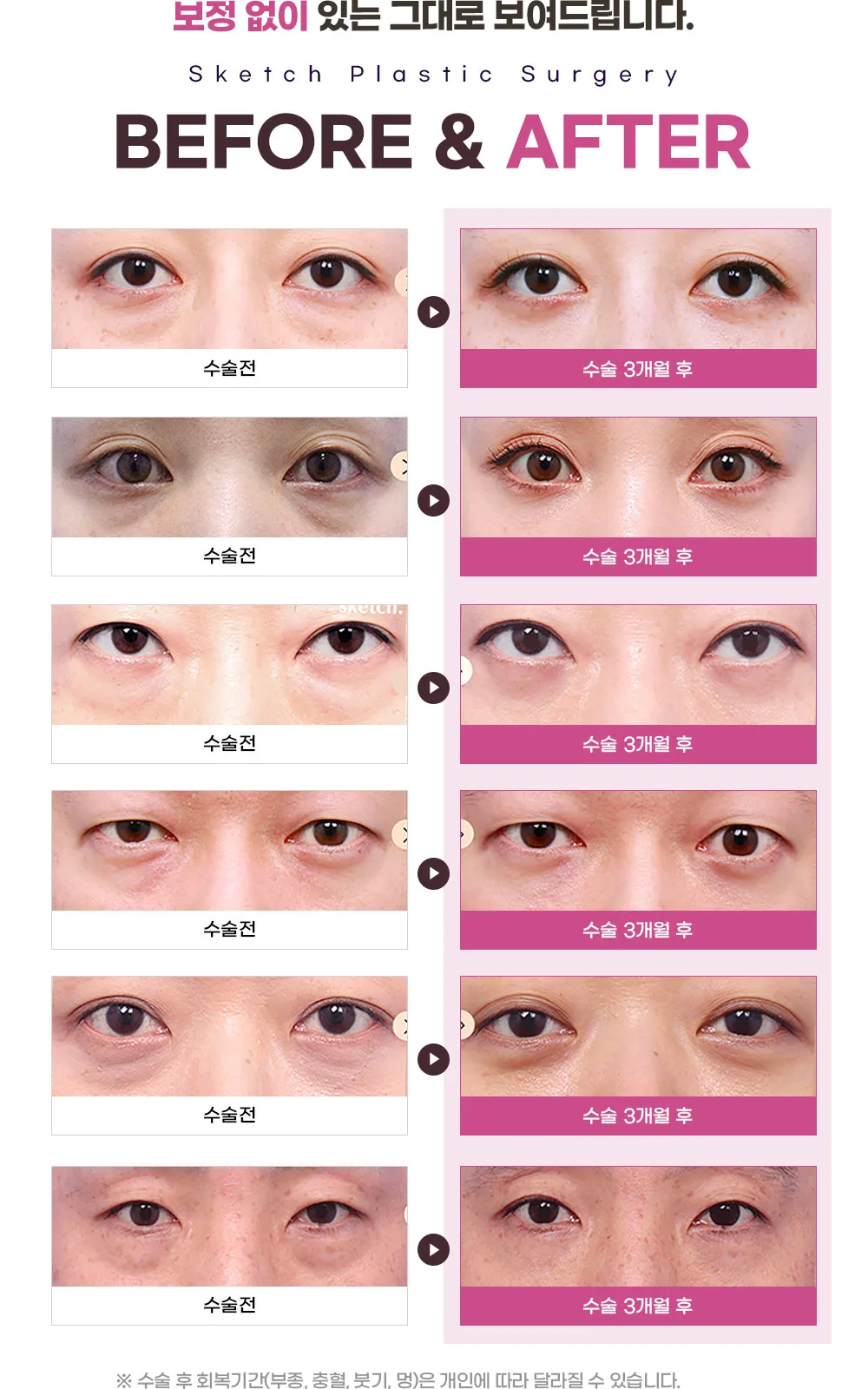 시술 상세 7
