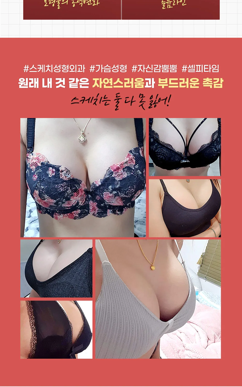 시술 상세 3