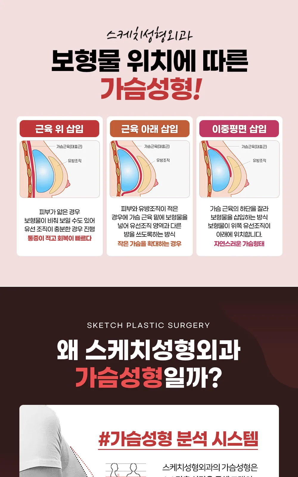 시술 상세 4