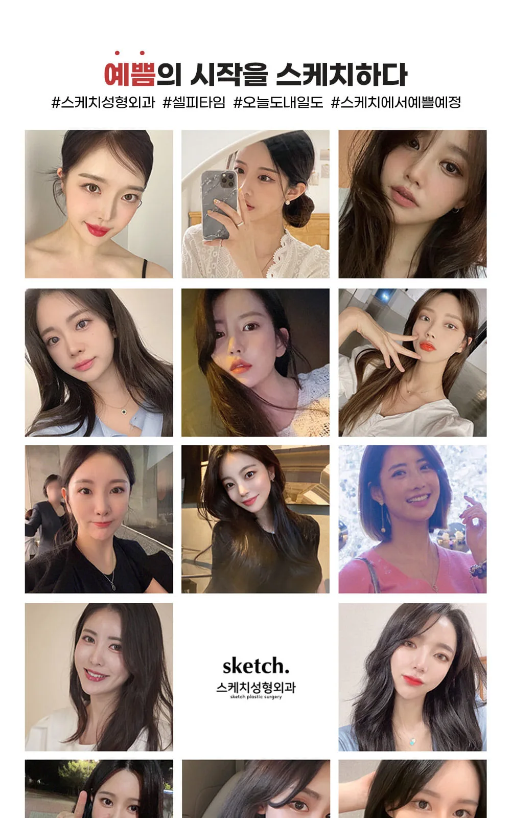 시술 상세 7