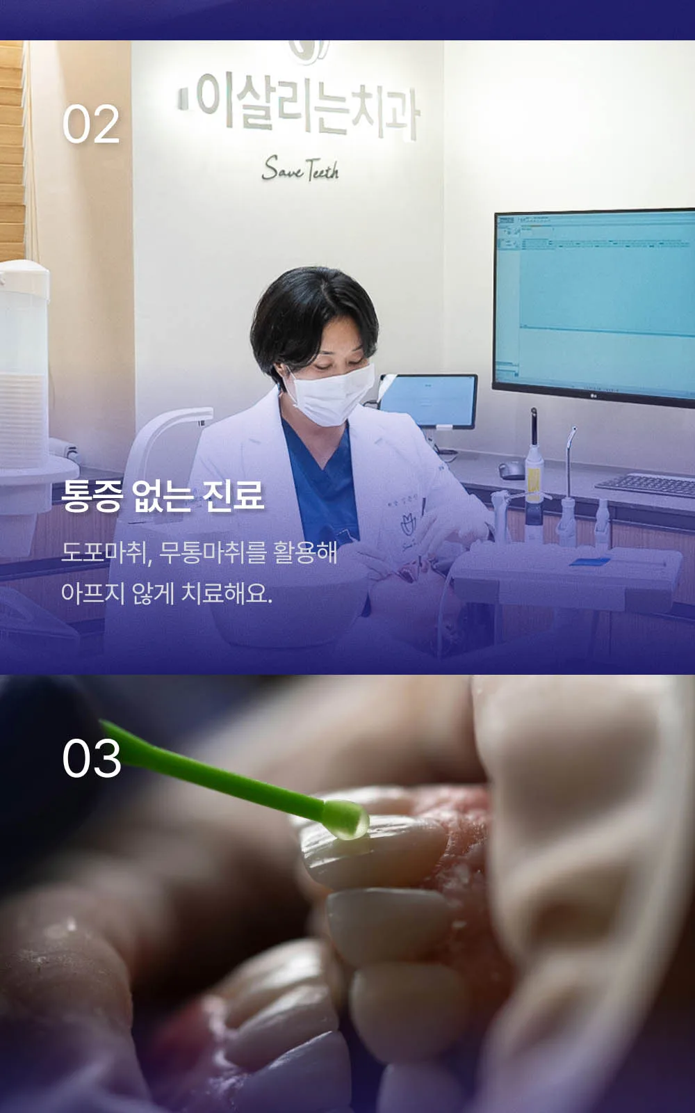 시술 상세 4