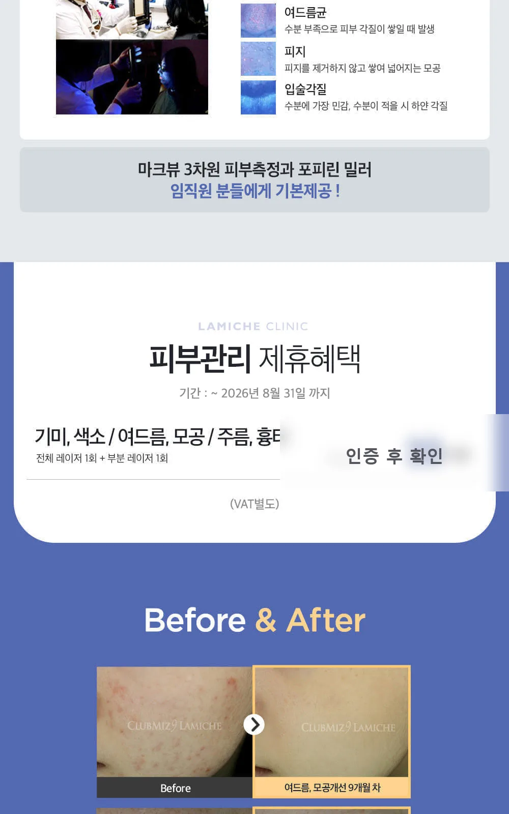 시술 상세 3