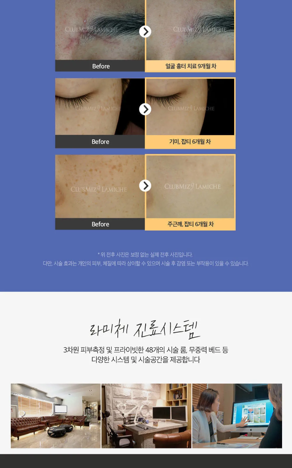 시술 상세 4