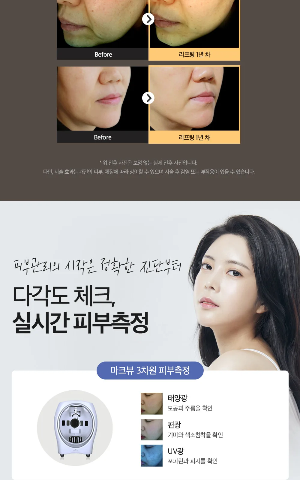 시술 상세 4