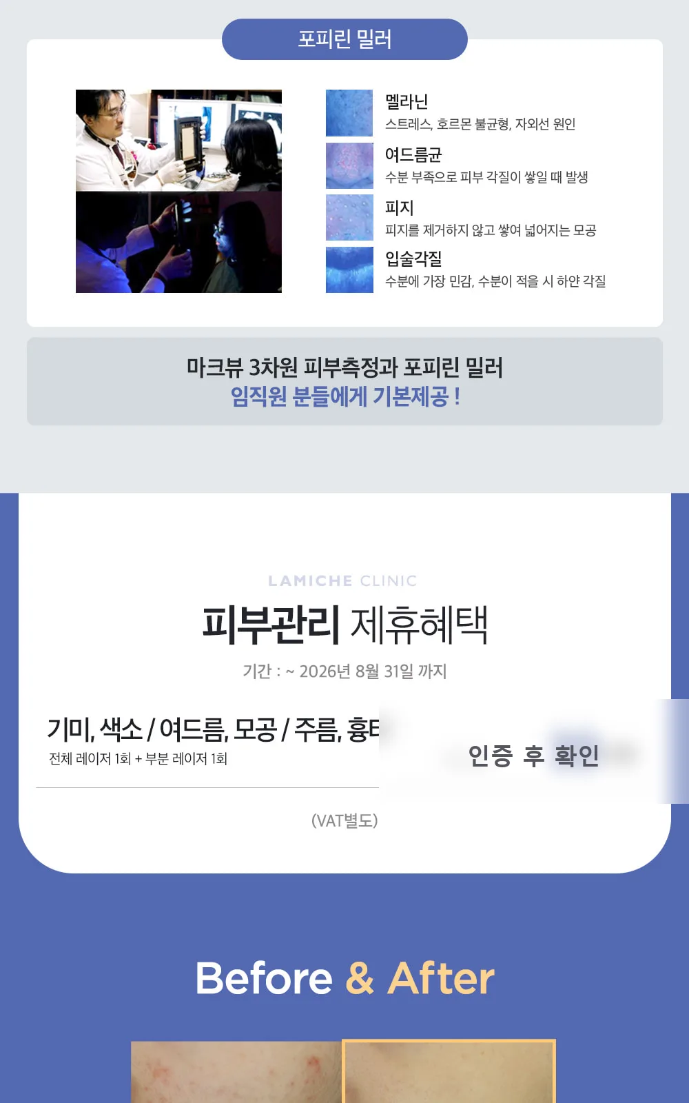시술 상세 5