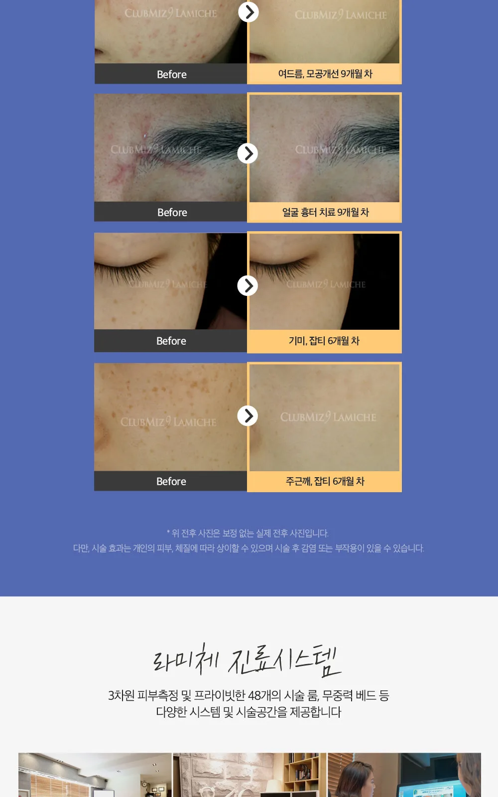 시술 상세 6