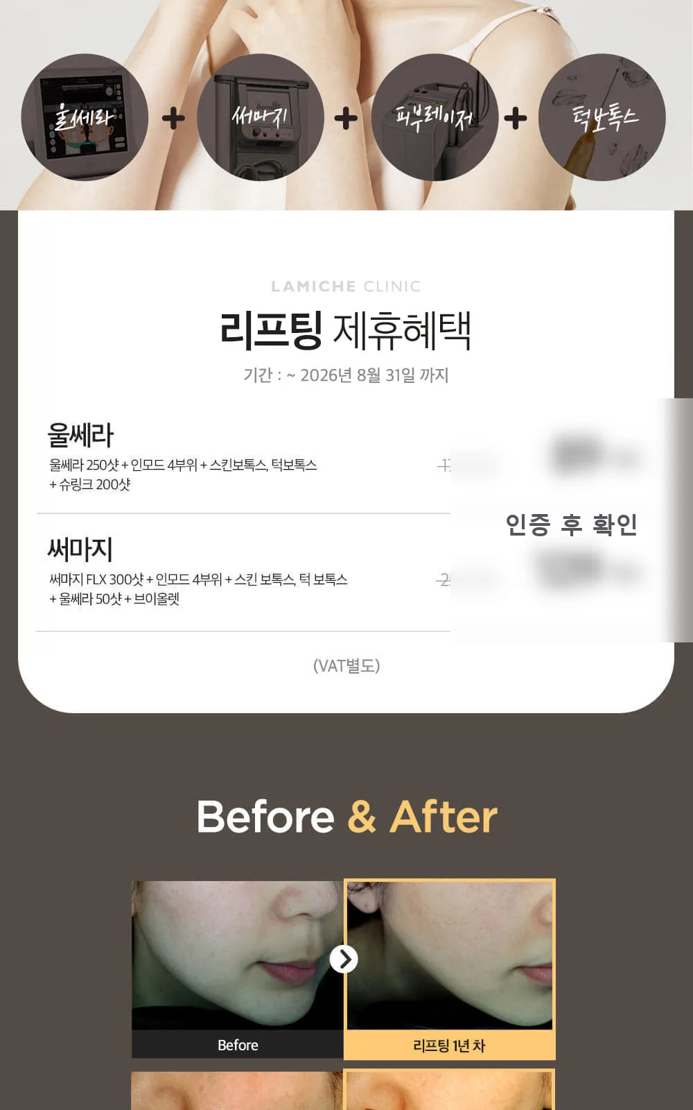 시술 상세 3