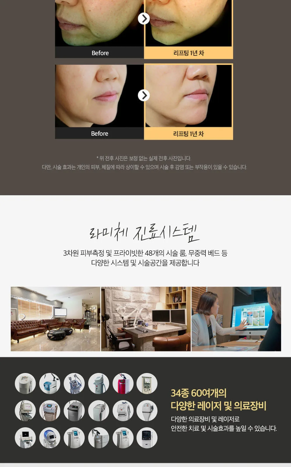 시술 상세 4