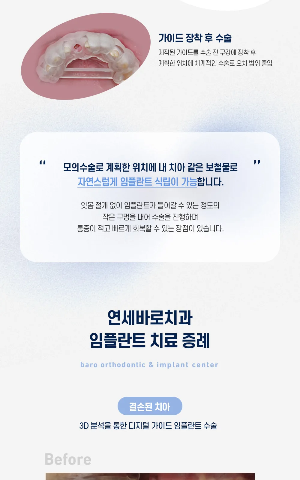 시술 상세 4