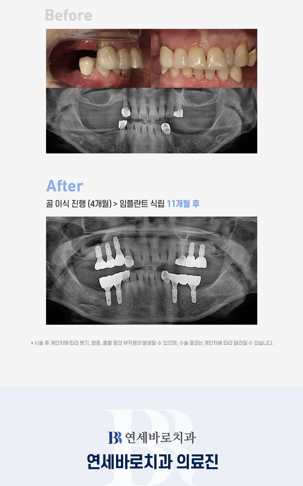 시술 상세 6