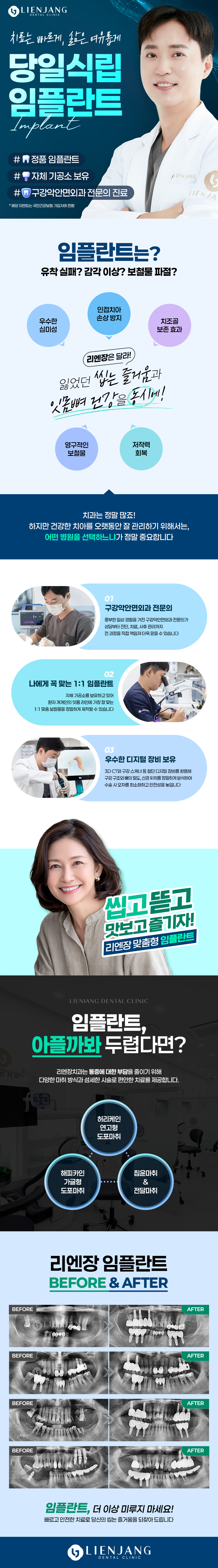 시술 상세 1