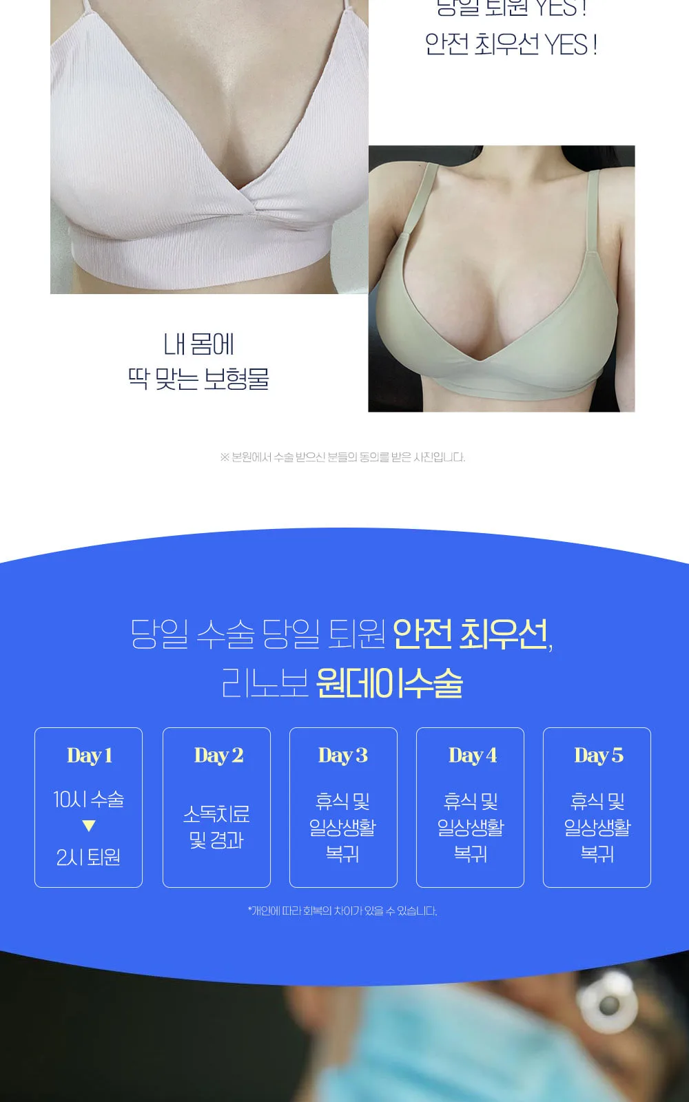 시술 상세 3