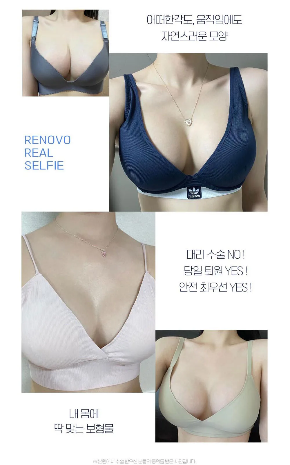 시술 상세 12