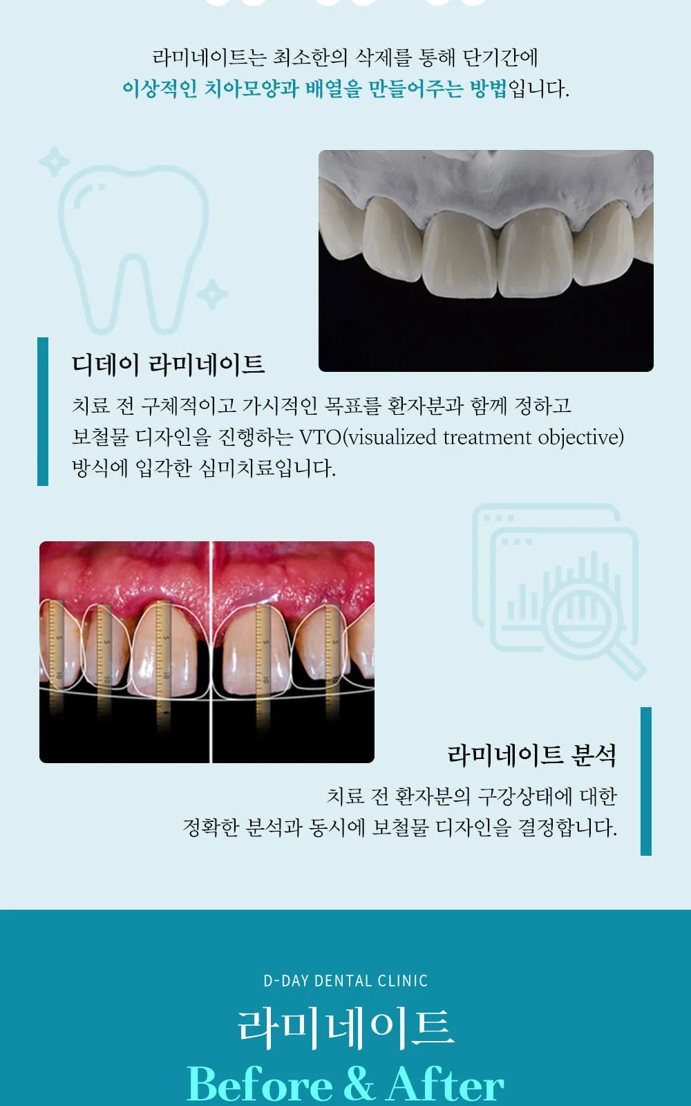 시술 상세 5