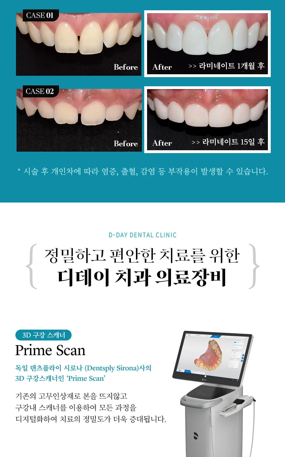 시술 상세 6