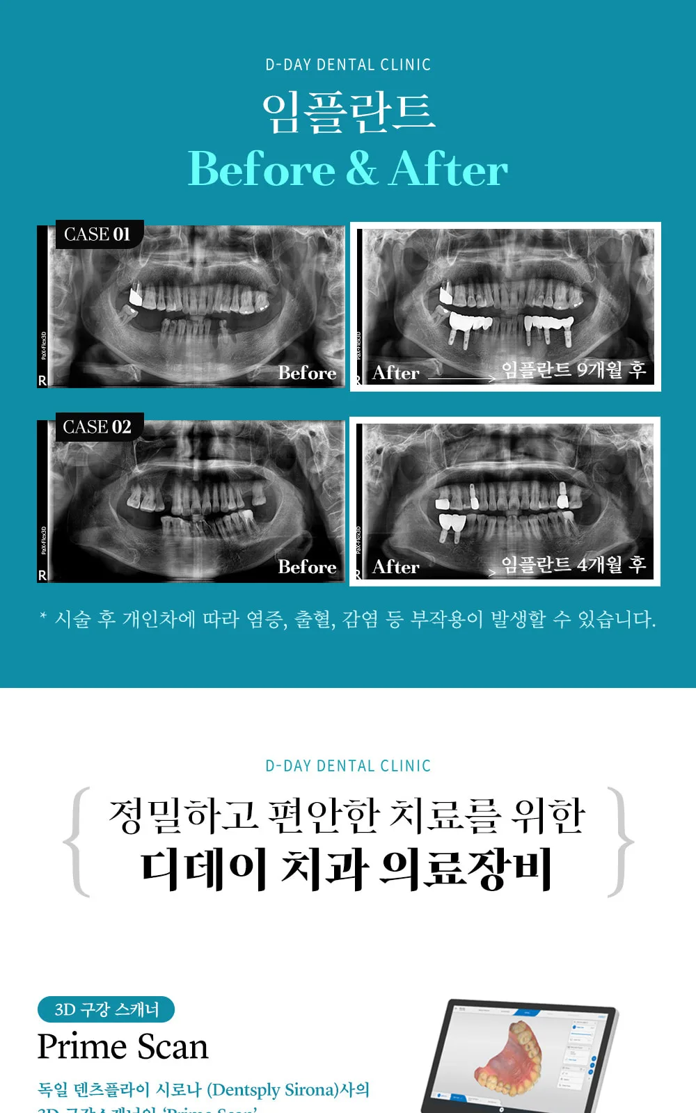 시술 상세 6