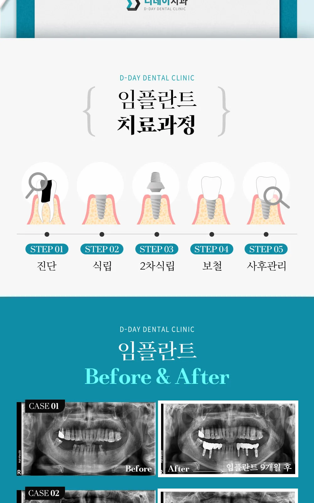 시술 상세 6