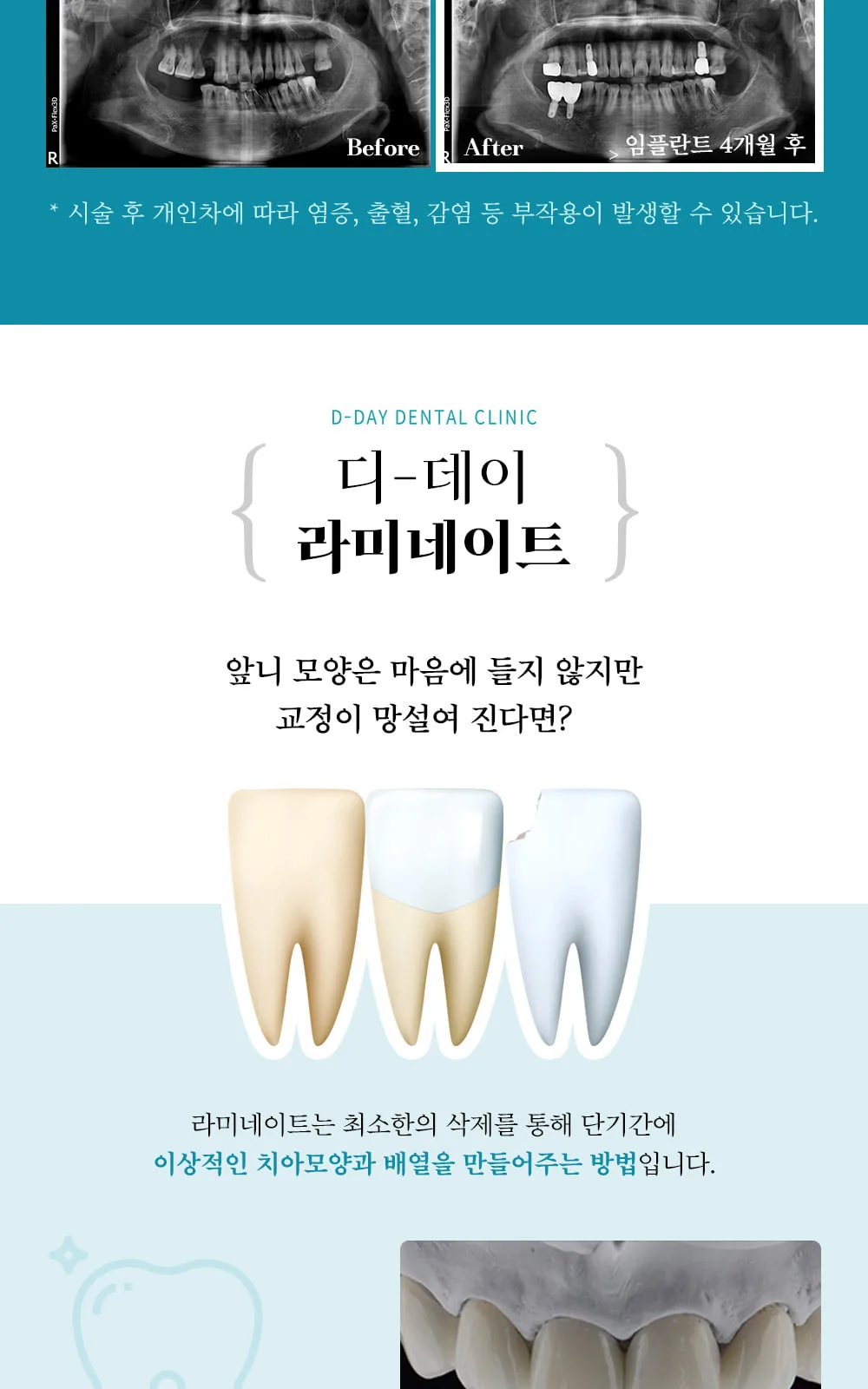 시술 상세 7