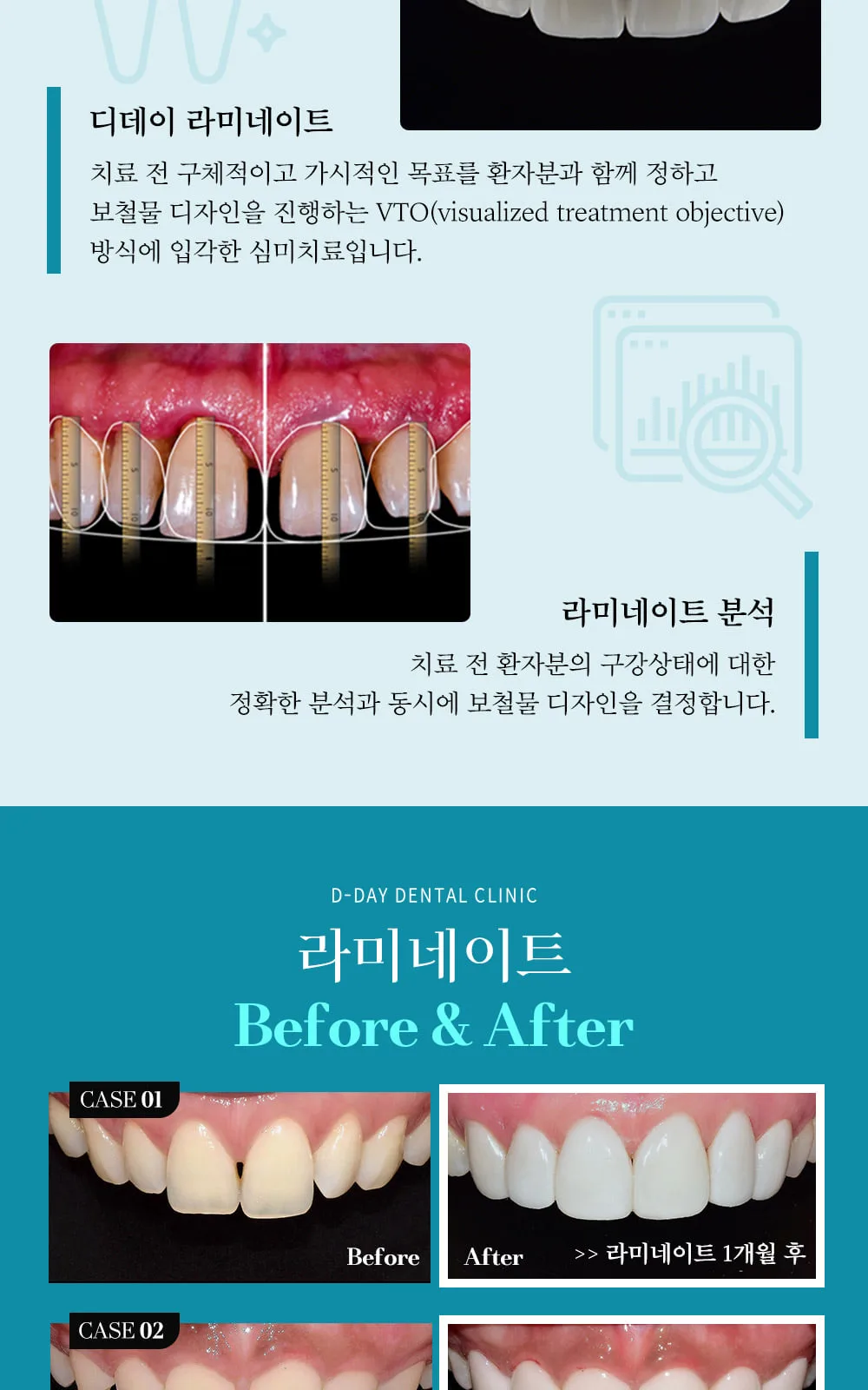 시술 상세 8