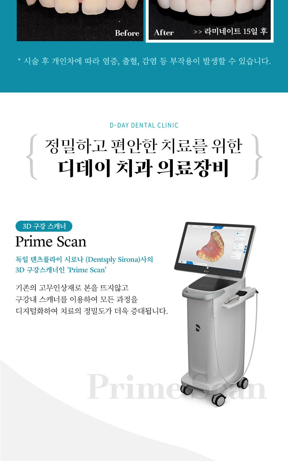 시술 상세 9
