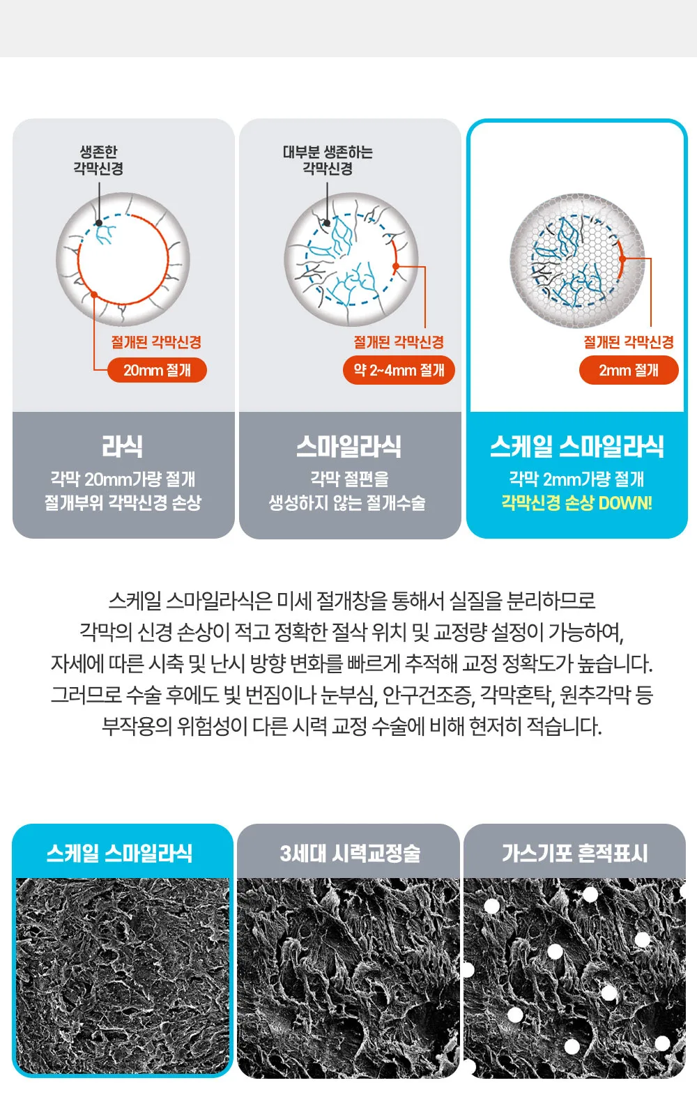 시술 상세 14
