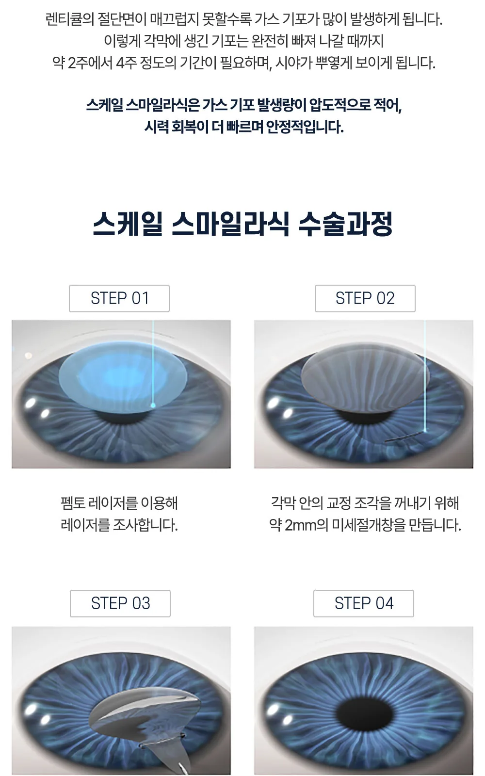 시술 상세 15