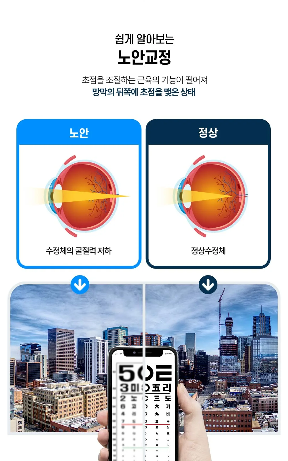 시술 상세 22