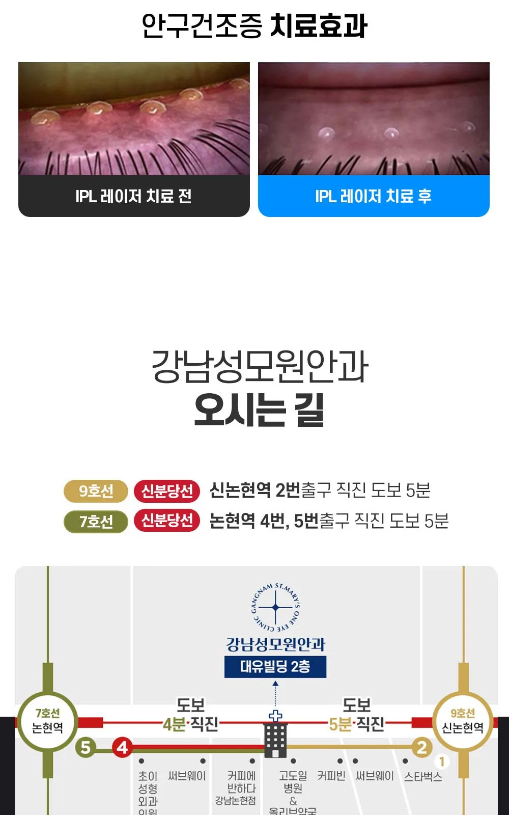시술 상세 32