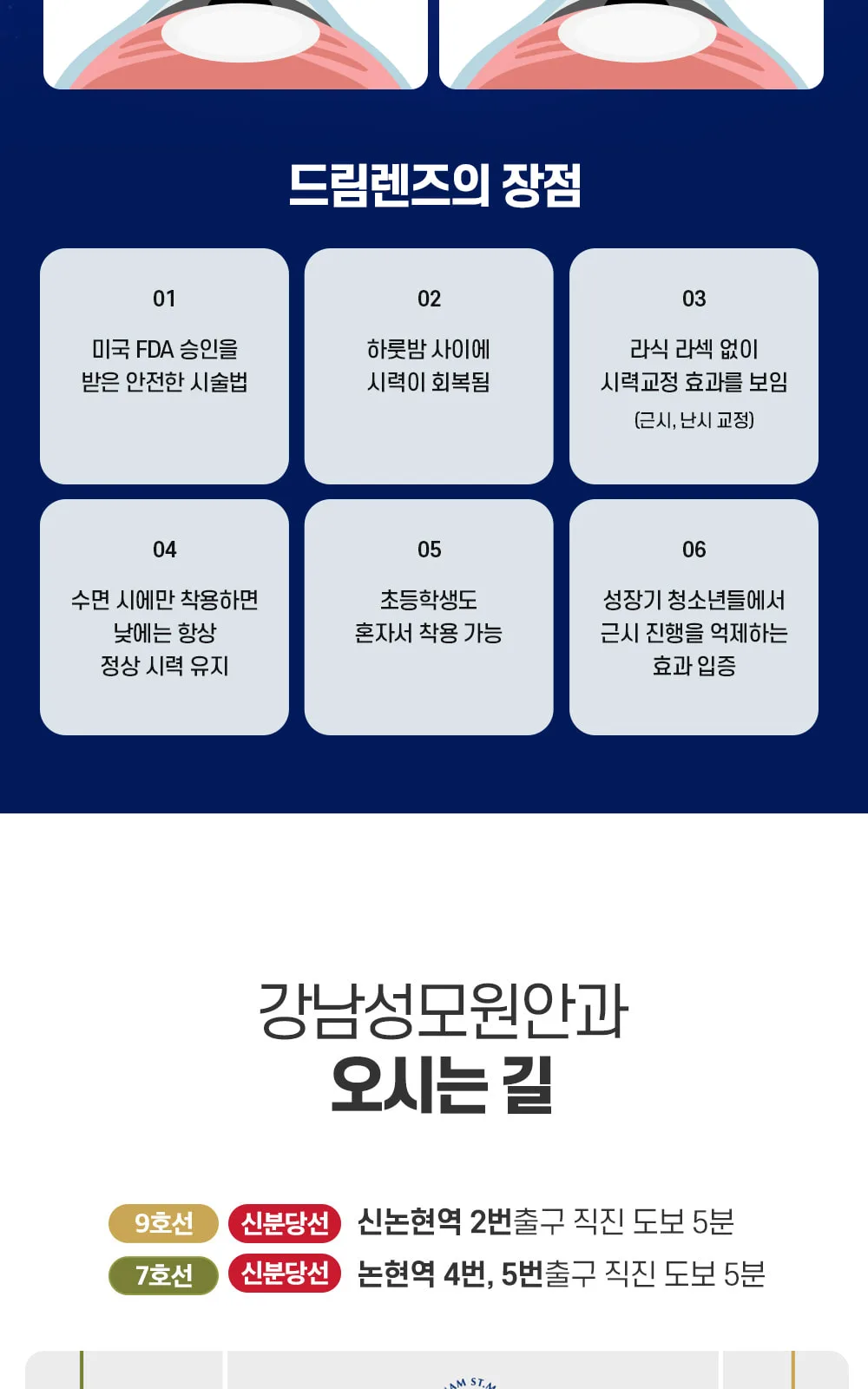 시술 상세 6