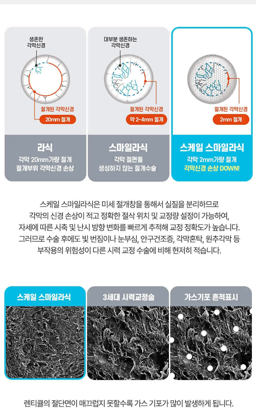시술 상세 11